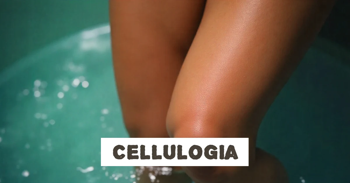 Cellulogia: A Complete Guide to Treating and Managing Cellulite Naturally