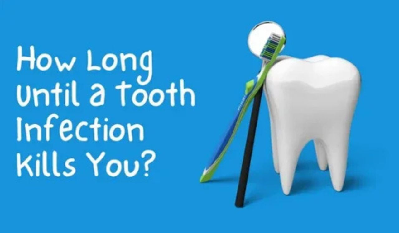 How Long Until A Tooth Infection Kills You Warning Signs And Treatment Guide