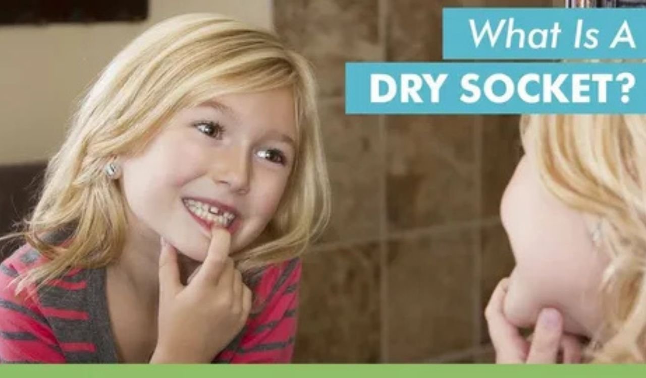 Can Dry Socket Heal on Its Own Without Treatment? Symptoms, Risks, and Recovery Explained Can Dry Socket Heal on Its Own Without Treatment? Symptoms, Risks, and Recovery Explained