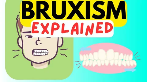Best Solutions For Bruxism Teeth Repair And Jaw Protection