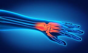 Hairline Fracture: Symptoms, Treatment,nt and Recovery