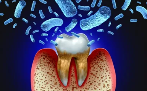 Antibiotics for Tooth Infection Types, Benefits, and Recovery Guide Antibiotics for Tooth Infection Types, Benefits, and Recovery Guide