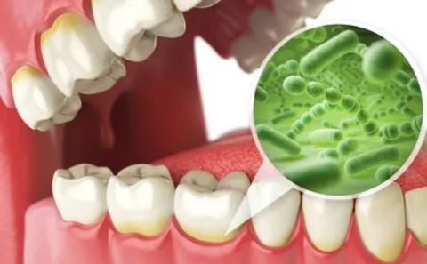Symptoms of Tooth Infection: How Long Until A Tooth Infection Kills You