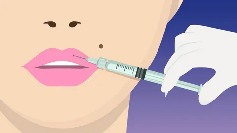 Lip Injections: How Long Does It Last and What Affects Results? Lip Injections: How Long Does It Last and What Affects Results?